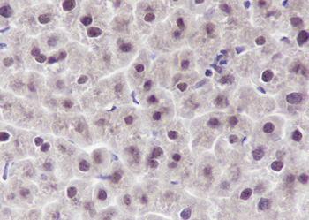 DDB1 Recombinant Mouse Monoclonal Antibody