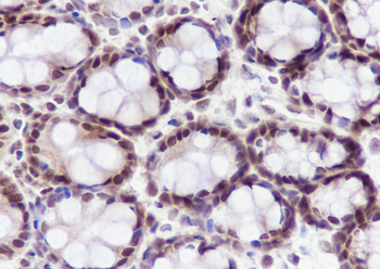 DDB1 Recombinant Mouse Monoclonal Antibody