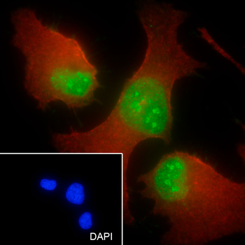 TDP-43 Recombinant Mouse Monoclonal Antibody