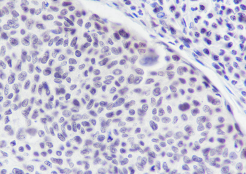 TDP-43 Recombinant Mouse Monoclonal Antibody