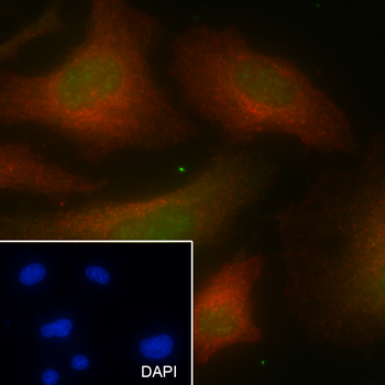 PABPN1 Recombinant Mouse Monoclonal Antibody