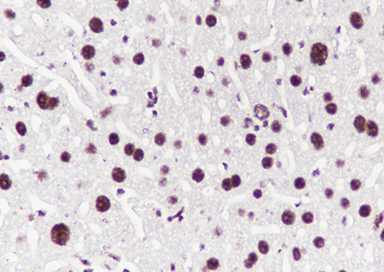 PABPN1 Recombinant Mouse Monoclonal Antibody