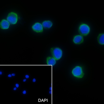 UBC12 Recombinant Mouse Monoclonal Antibody