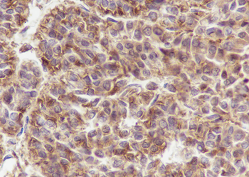 UBC12 Recombinant Mouse Monoclonal Antibody