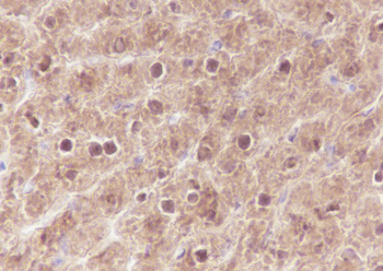 SETBP1 Recombinant Rabbit Monoclonal Antibody