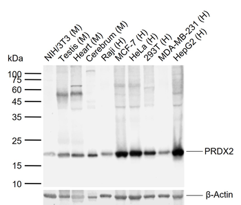 PRDX2 Recombinant Mouse Monoclonal Antibody