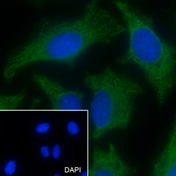RAB3GAP1 Recombinant Mouse Monoclonal Antibody