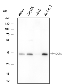 DCPS Recombinant Mouse Monoclonal Antibody