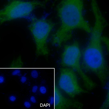 CLTL Recombinant Mouse Monoclonal Antibody