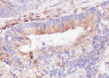 STING1 Recombinant Rabbit Monoclonal Antibody
