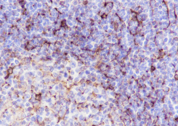 STING1 Recombinant Rabbit Monoclonal Antibody