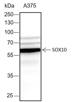 SOX10 Recombinant Rabbit Monoclonal Antibody