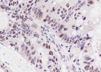 MSH6 Recombinant Mouse Monoclonal Antibody