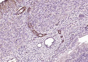Caldesmon Recombinant Mouse Monoclonal Antibody