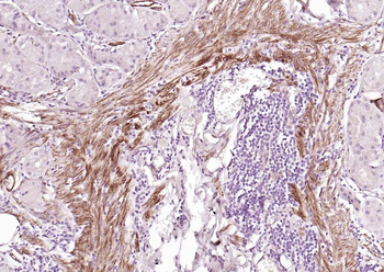 Caldesmon Recombinant Mouse Monoclonal Antibody
