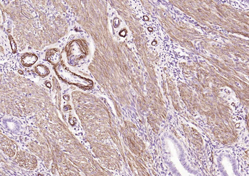 Caldesmon Recombinant Mouse Monoclonal Antibody