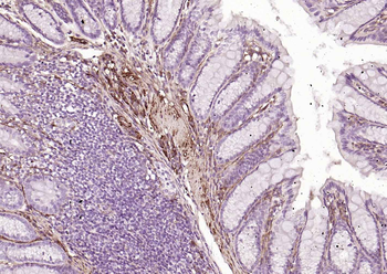 Caldesmon Recombinant Mouse Monoclonal Antibody