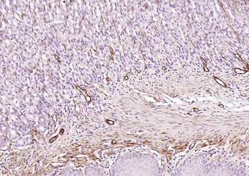 Caldesmon Recombinant Mouse Monoclonal Antibody