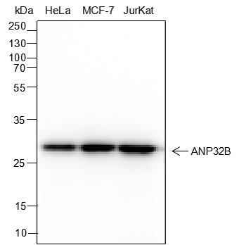 ANP32B Recombinant Mouse Monoclonal Antibody