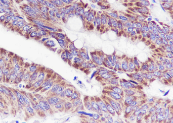 MTCO2 Recombinant Mouse Monoclonal Antibody
