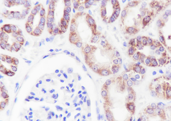 MTCO2 Recombinant Mouse Monoclonal Antibody