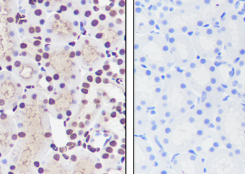Mono-Methyl-Histone H3 (Lys23) Recombinant Rabbit Monoclonal Antibody