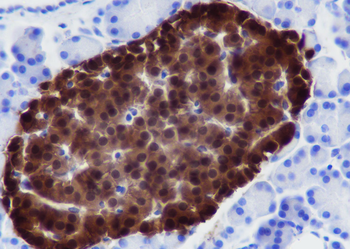SCGN Recombinant Rabbit Monoclonal Antibody