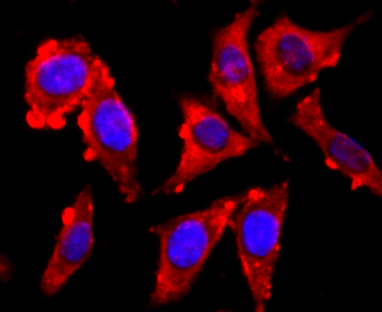 VAMP2 Recombinant Rabbit Monoclonal Antibody