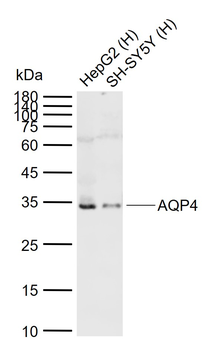 AQP4 Rabbit Polyclonal Antibody