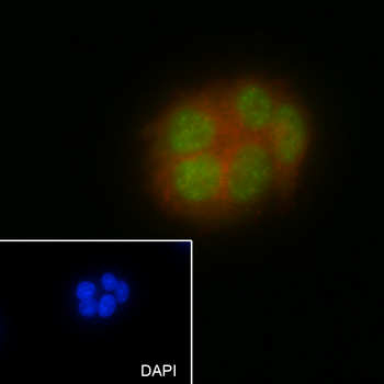 NUDT21 Recombinant Mouse Monoclonal Antibody