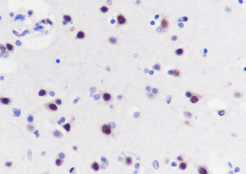 NUDT21 Recombinant Mouse Monoclonal Antibody