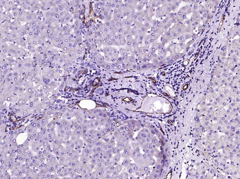 CD31 Recombinant Rabbit Monoclonal Antibody