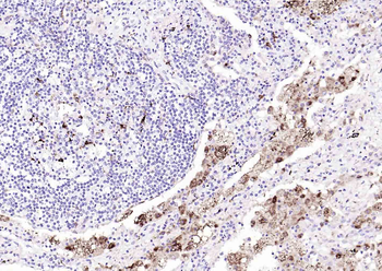 CD68 Mouse Monoclonal Antibody