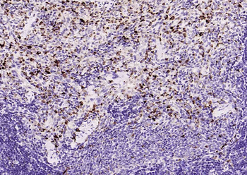 CD68 Mouse Monoclonal Antibody