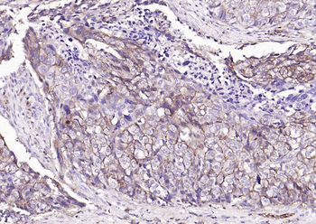 Human CD44 Mouse Monoclonal Antibody