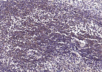 Human CD44 Mouse Monoclonal Antibody