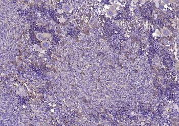 NCAM Recombinant Rabbit Monoclonal Antibody