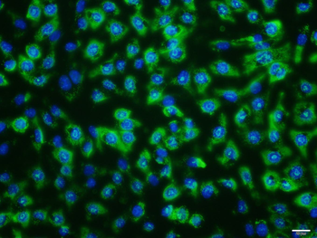 NCAM Recombinant Rabbit Monoclonal Antibody