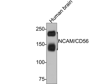 NCAM Recombinant Rabbit Monoclonal Antibody