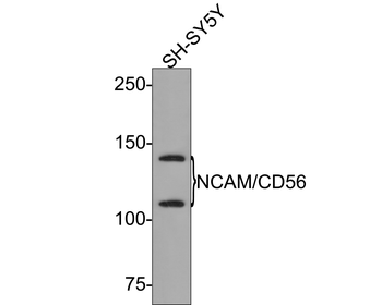 NCAM Recombinant Rabbit Monoclonal Antibody