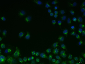 Human CD71 Mouse Monoclonal Antibody