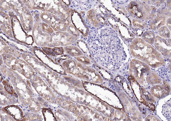 PLAUR Mouse Monoclonal Antibody