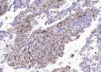 PLAUR Mouse Monoclonal Antibody