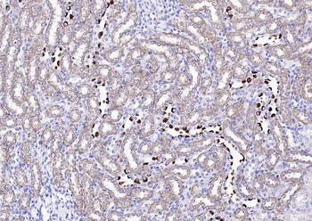 PLAUR Mouse Monoclonal Antibody