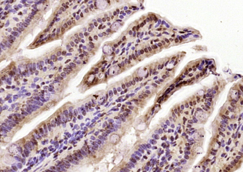 HCF2 Rabbit Polyclonal Antibody