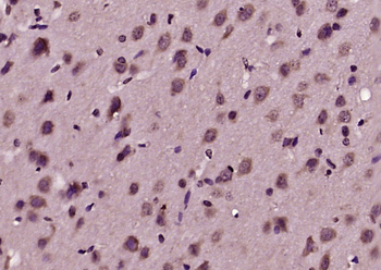 SORBS2 Rabbit Polyclonal Antibody