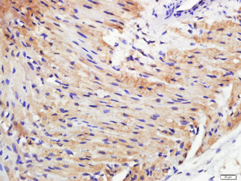 MYH7 Rabbit Polyclonal Antibody