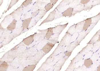 MYH7 Rabbit Polyclonal Antibody
