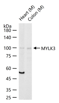 MYLK3 Rabbit Polyclonal Antibody