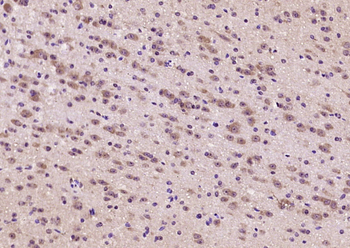 ANKRD33B Rabbit Polyclonal Antibody